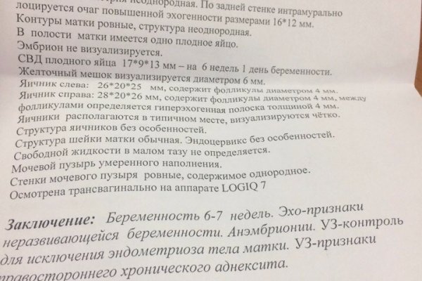 Кракен сайт kr2web in зарегистрироваться